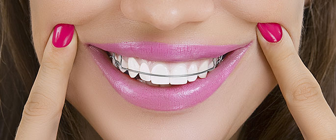 Aparelhos Ortopédicos